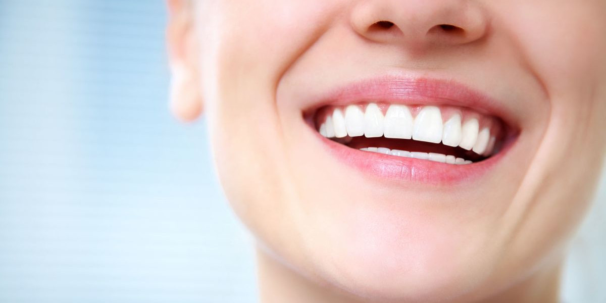 Get the Perfect White Smile: Crest Teeth Whitening Step-by-Step